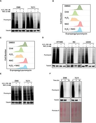 Auranofin and reactive oxygen species inhibit protein synthesis and regulate the level of the PLK1 protein in Ewing sarcoma cells